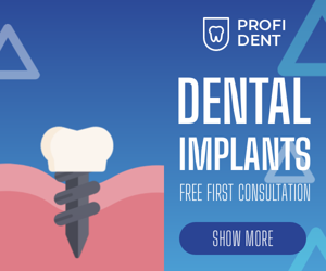 Dental Implants — Free First Consultation